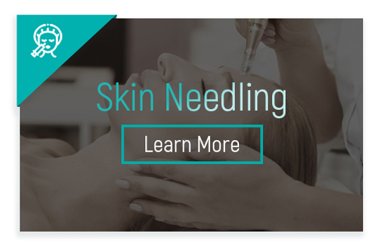 skin needling FAQ
