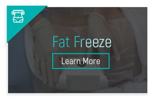 fat freeze FAQ