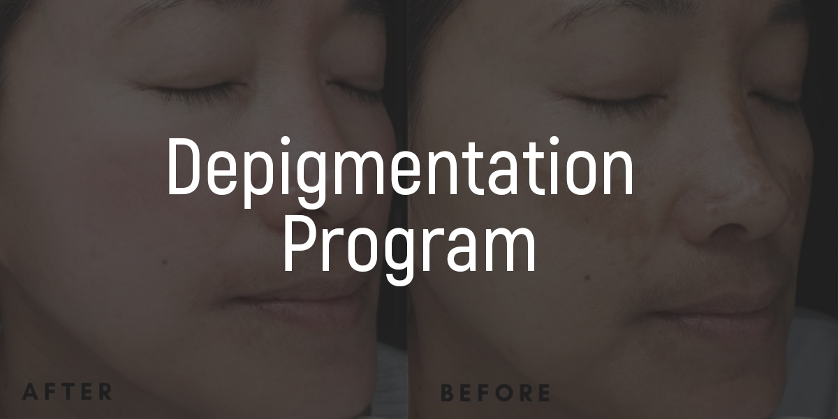 faq temple depigmentation program