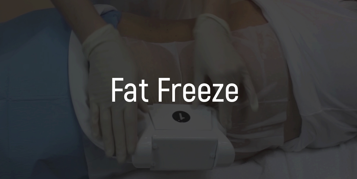 fat-freeze stubborn fat