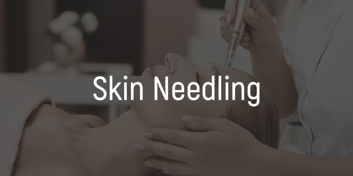 FAQ skin-needling