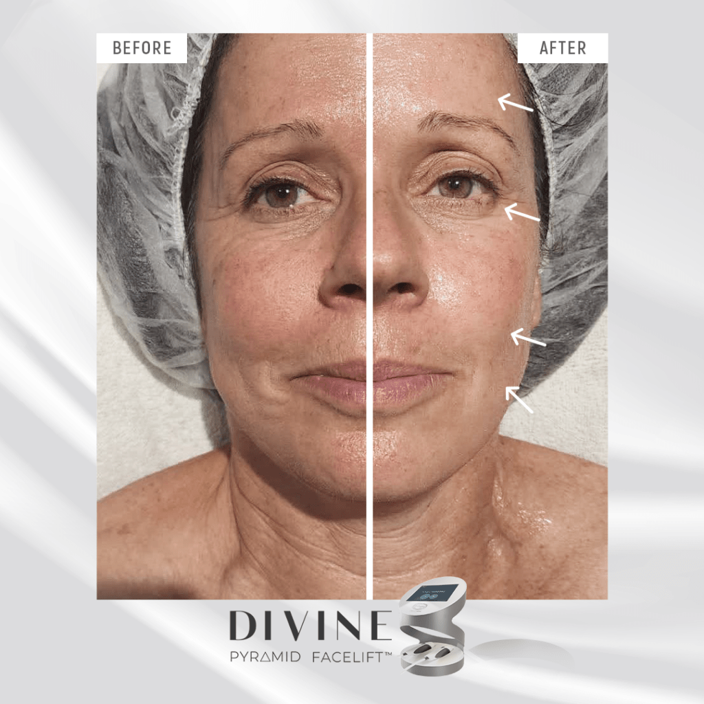 divine pro facial rejuvenation temple skincare & spa