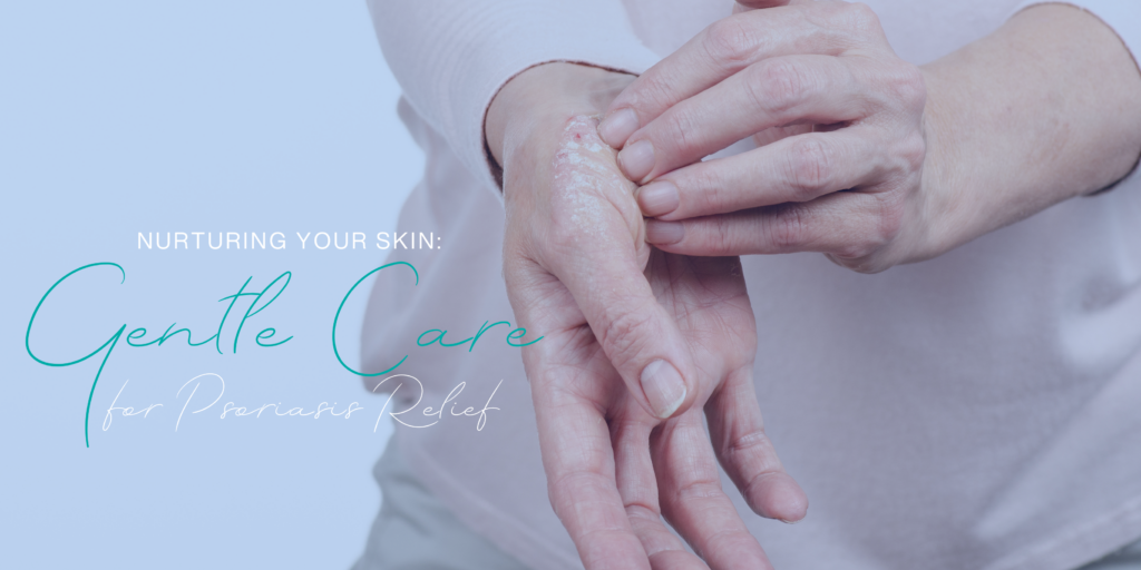 Nurturing Your Skin Gentle Care for Psoriasis Relief Temple Skincare & Spa