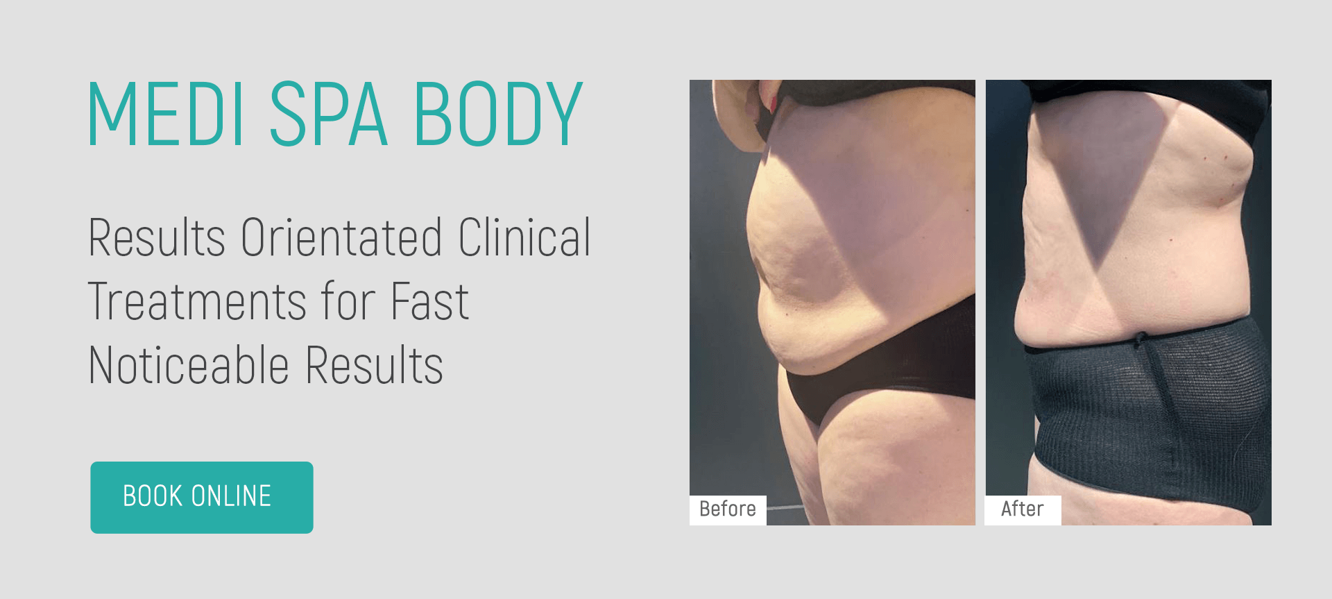When is the Perfect Time for Body Contouring? - Just Melt Med Spa
